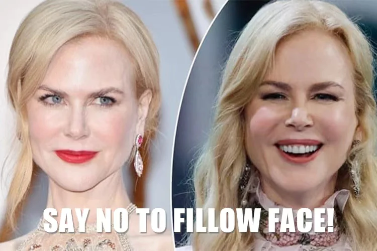 what is pillow face